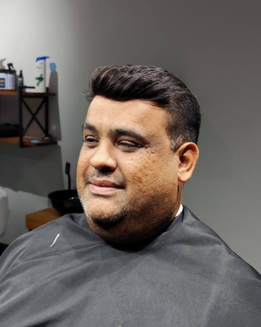 Depois - Prótese Capilar Ral Clinic